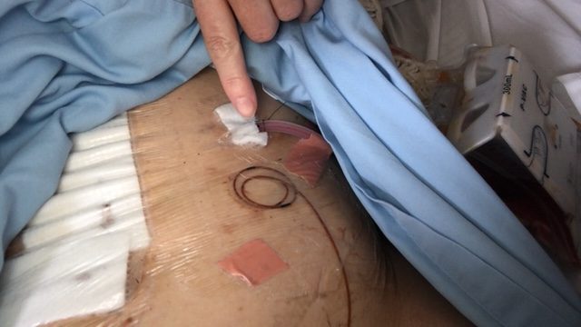 Drain and anaesthetic system